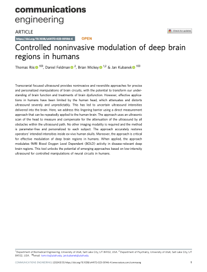 Article on practical correction for the ultrasound distortions by the human head published