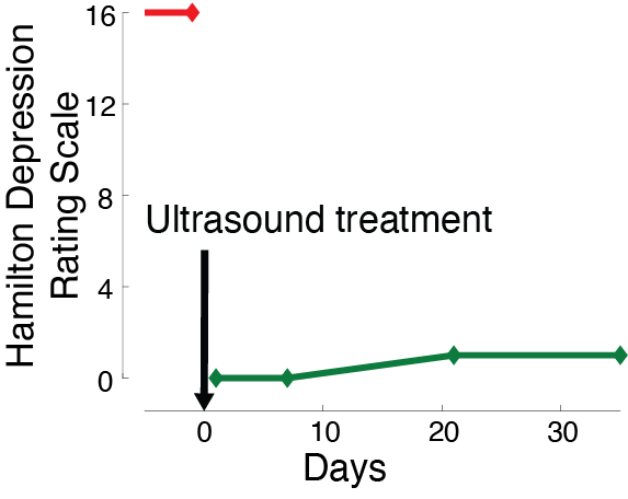 Effective and safe treatment of depression